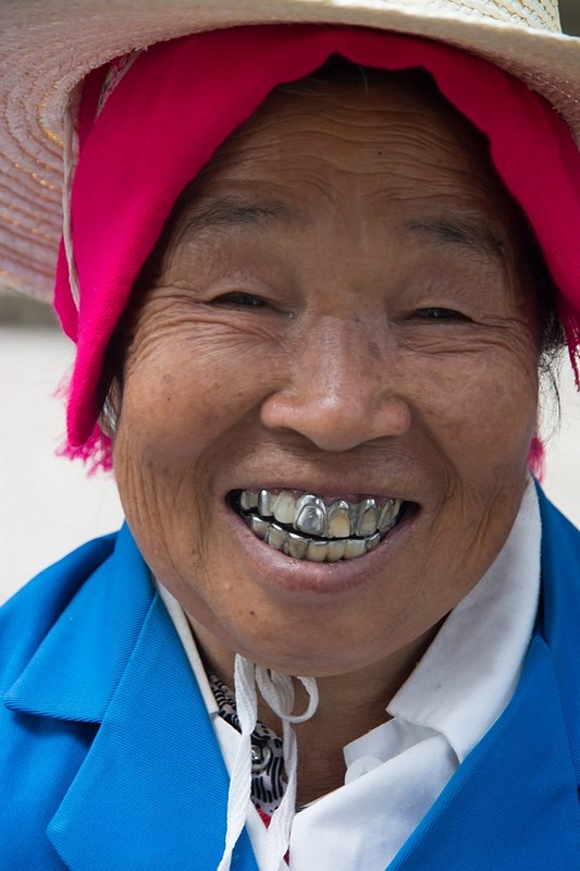 צחוק יפה לבריאות