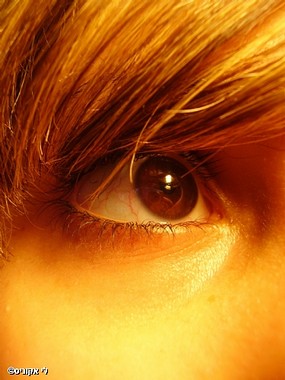 צילום: לי אקוניס